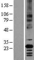 CD147 (BSG) Human Over-expression Lysate