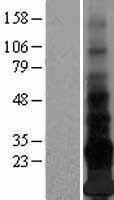 Adropin (ENHO) Human Over-expression Lysate