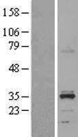 HSD11B1L Human Over-expression Lysate