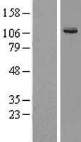 KIF7 Human Over-expression Lysate