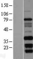 CIBAR2 Human Over-expression Lysate