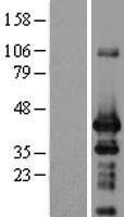 ING1 Human Over-expression Lysate