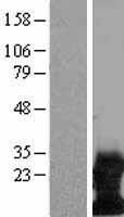 DAP12 (TYROBP) Human Over-expression Lysate