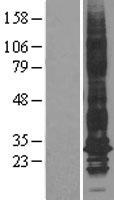 Aquaporin 1 (AQP1) Human Over-expression Lysate