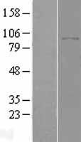 DPP8 Human Over-expression Lysate