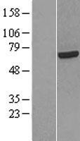 HCC1 (RBM39) Human Over-expression Lysate