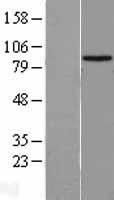 HECTD2 Human Over-expression Lysate