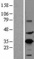 CREM Human Over-expression Lysate