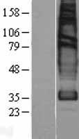 Solute carrier family 22 member 18 (SLC22A18) Human Over-expression Lysate