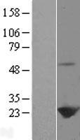 Peroxiredoxin 1 (PRDX1) Human Over-expression Lysate