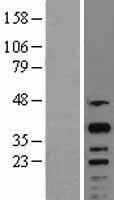 CREM Human Over-expression Lysate