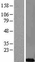 CREM Human Over-expression Lysate