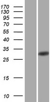 HLA-DQB2 Human Over-expression Lysate