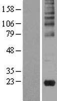 Gastrokine 2 (GKN2) Human Over-expression Lysate