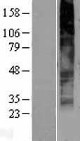 GPR141 Human Over-expression Lysate