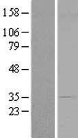 PRR6 (CENPV) Human Over-expression Lysate