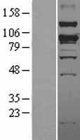 SMURF1 Human Over-expression Lysate