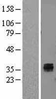IL22 RA2 (IL22RA2) Human Over-expression Lysate