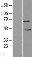 LYRIC (MTDH) Human Over-expression Lysate