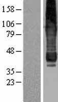 GPAT4 Human Over-expression Lysate