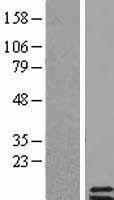 Tuberoinfundibular peptide (PTH2) Human Over-expression Lysate