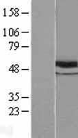 beta V Tubulin (TUBB) Human Over-expression Lysate
