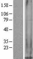 MT1M Human Over-expression Lysate