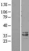 PHYHD1 Human Over-expression Lysate