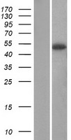 SERPINA12 Human Over-expression Lysate
