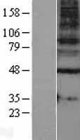 GABA A Receptor gamma 1 (GABRG1) Human Over-expression Lysate