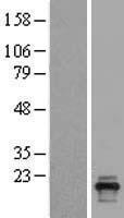 PLAC1L (OOSP2) Human Over-expression Lysate