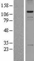 PASD1 Human Over-expression Lysate