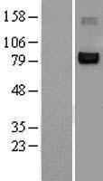 NFAT2 (NFATC1) Human Over-expression Lysate