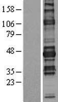 NFAT2 (NFATC1) Human Over-expression Lysate