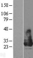 KCNE2 Human Over-expression Lysate