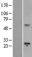 IL15RA Human Over-expression Lysate