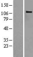 CBLB Human Over-expression Lysate