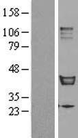 IKIP (IKBIP) Human Over-expression Lysate