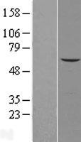 AGPAT7 (LPCAT4) Human Over-expression Lysate
