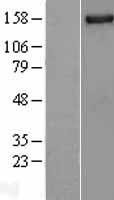 NUP155 Human Over-expression Lysate