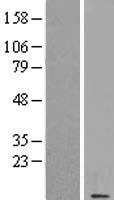 CSAG1 Human Over-expression Lysate