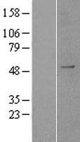 KDM1B Human Over-expression Lysate