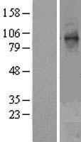 STT3A Human Over-expression Lysate