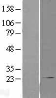 COMMD1 Human Over-expression Lysate