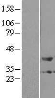 ZADH1 (PTGR2) Human Over-expression Lysate