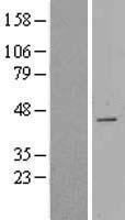 CDCA7 Human Over-expression Lysate