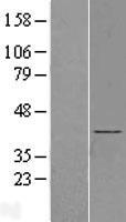 BBS5 Human Over-expression Lysate