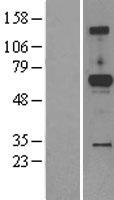 ACPL2 (PXYLP1) Human Over-expression Lysate