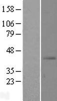 SLC39A13 Human Over-expression Lysate
