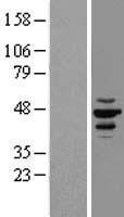 CK1 epsilon (CSNK1E) Human Over-expression Lysate